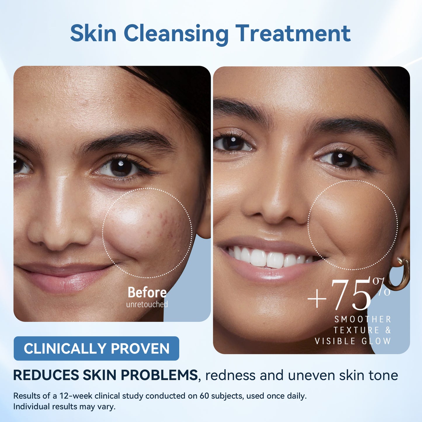 LED Light Therapy Mask Skin Care Mask, LED Red 630±5nm & NIR 830nm Wavelength for Home Use